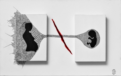 Leonardo Frigo | Aborto-abortion-avortement-аборт-유산