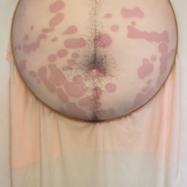 Sally Hewett | Sore-I-ah-sis