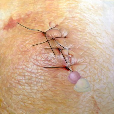 Sofia Bracamontes | Ginocchio