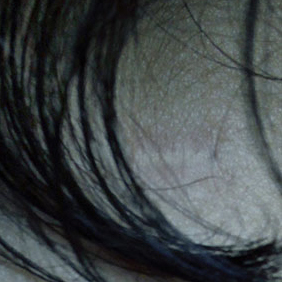  | Lost on green planet - dettaglio 2