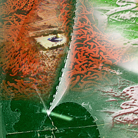  | Incision of a 3rd Kind Jerusalem