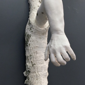  | Limb