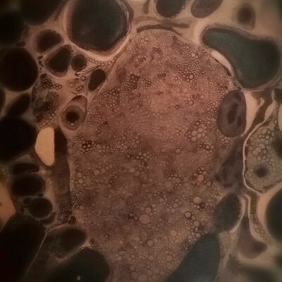  | Cellule della tiroide