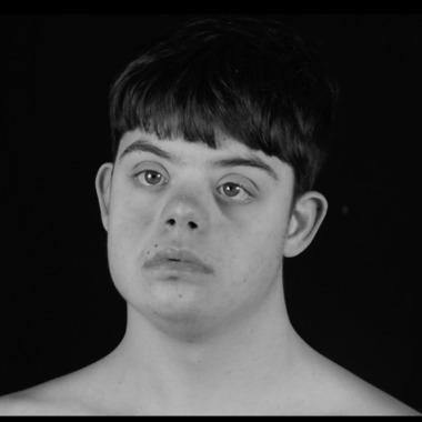 Chiara Cunzolo | Free Down Syndrome