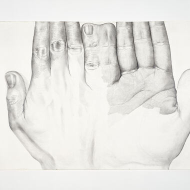 Esmeraldo Baha | My wright hand skin