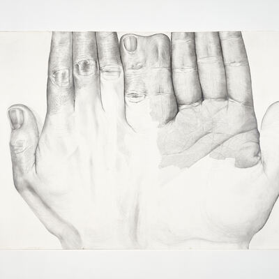 | My wright skin hand